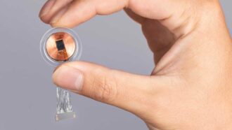 Neuralink acirra a corrida por chips cerebrais